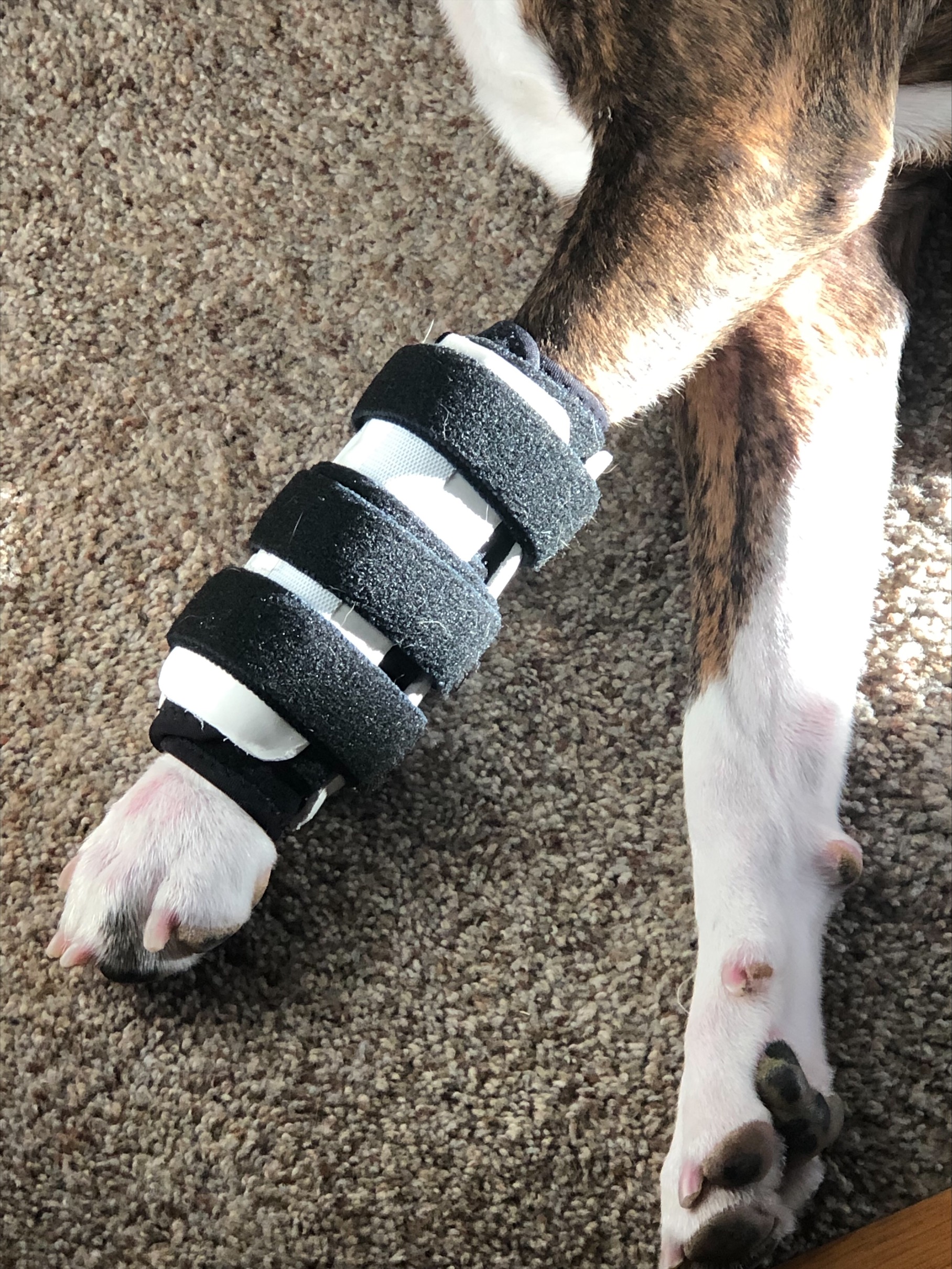 CoCo Carpal Support with External Splint